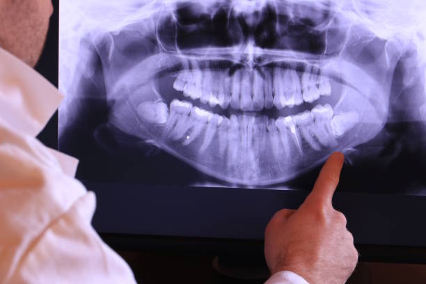 Best Emergency Gum Treatment in Wesley Chapel, NC