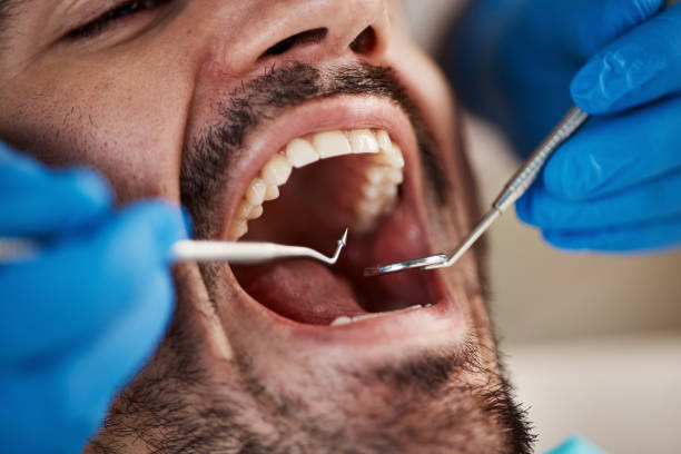 Best Emergency Treatment for Dental Infections or Abscesses in Wesley Chapel, NC
